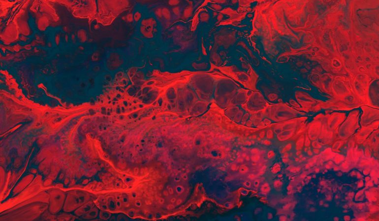 Anticorps Anti-Thyroglobuline Élevé : Que Faire Face à Vos Résultats ?